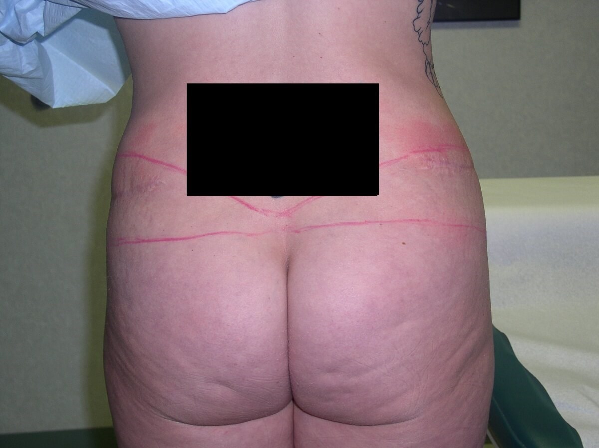 Back View Before