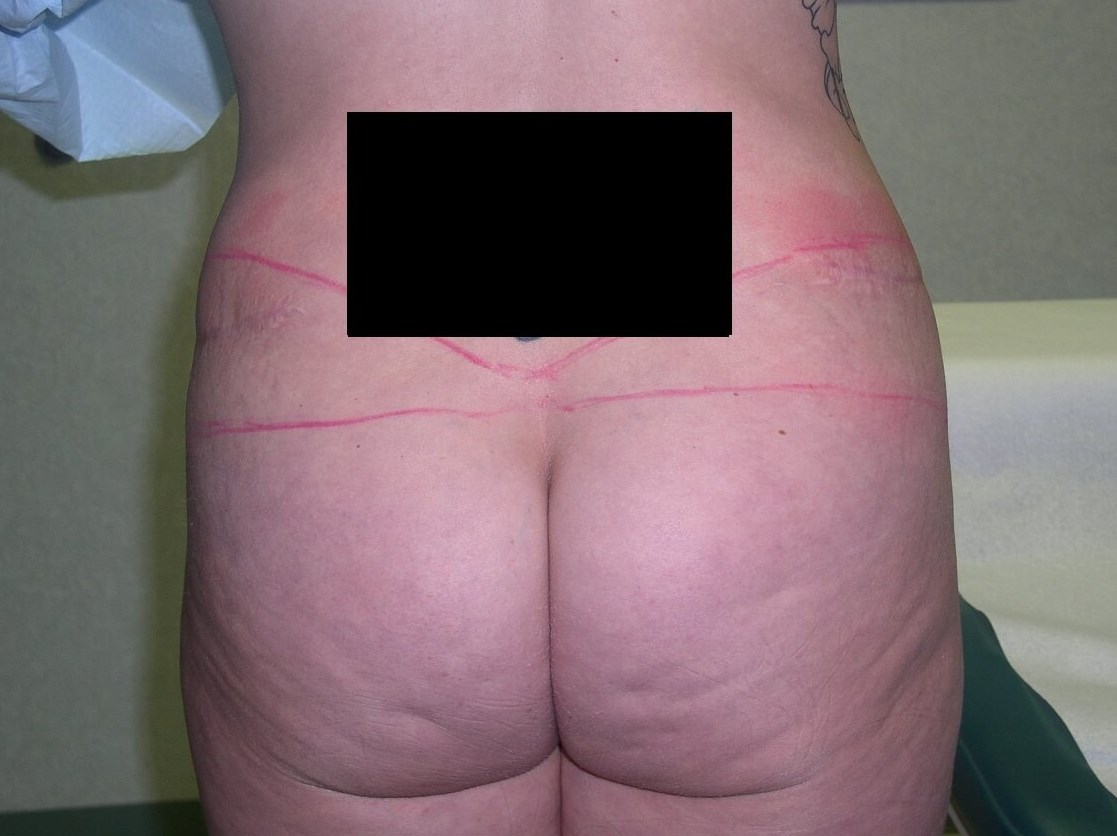 Back View Before