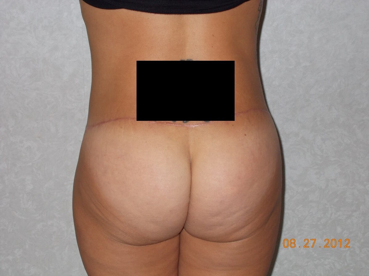 Back View After