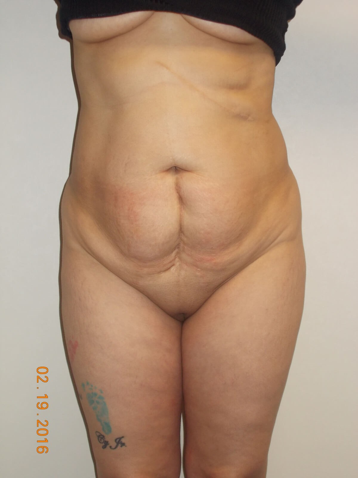 Before Image