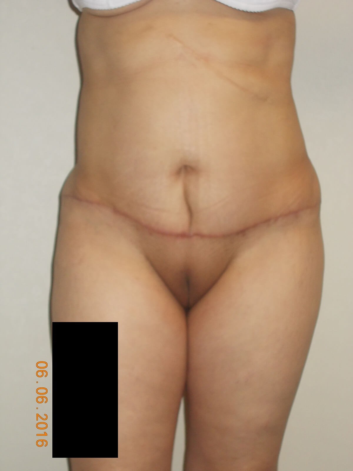 After Image